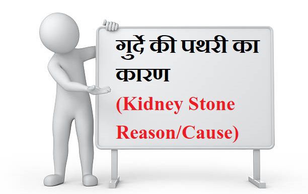pathri ka karan stone cause reason in hindi