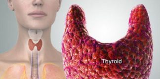 थायराइड का इलाज thyroid ka ilaj in hindi