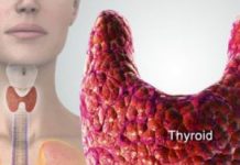 थायराइड का अचूक उपचार thyroid ka ilaj in hindi
