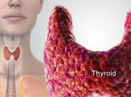 थायराइड का अचूक उपचार thyroid ka ilaj in hindi