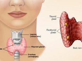 थायराइड का इलाज परहेज thyroid mein aahar diet plan in hindi